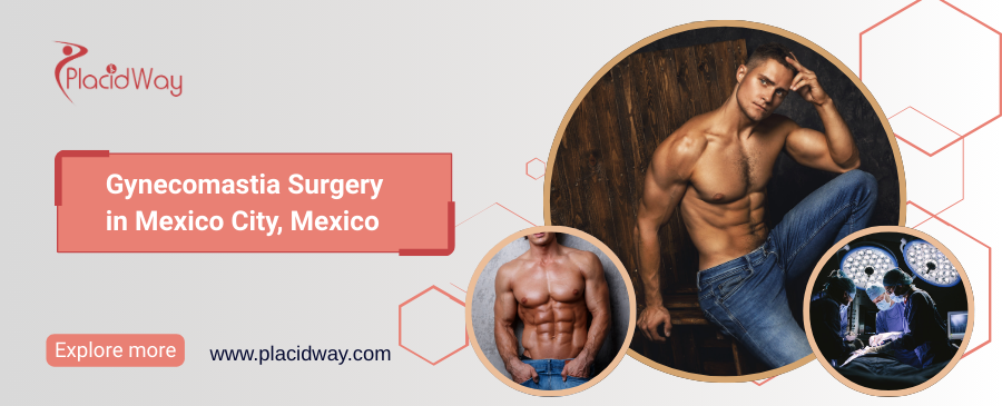 Gynecomastia Surgery in Mexico City, Mexico