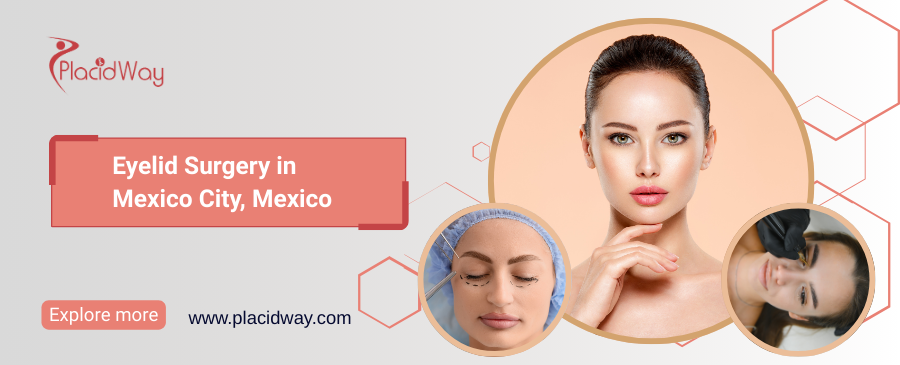 Eyelid Surgery in Mexico City, Mexico