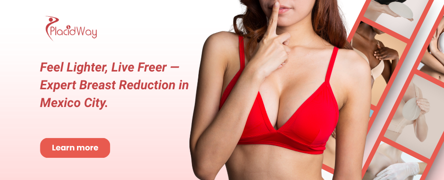 Breast Reduction in Mexico City, Mexico