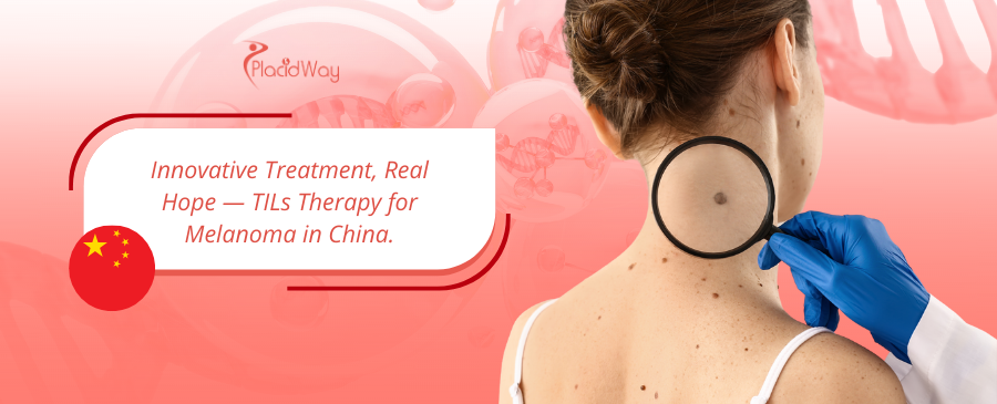 Immunotherapy China: TILs Therapy for Melanoma