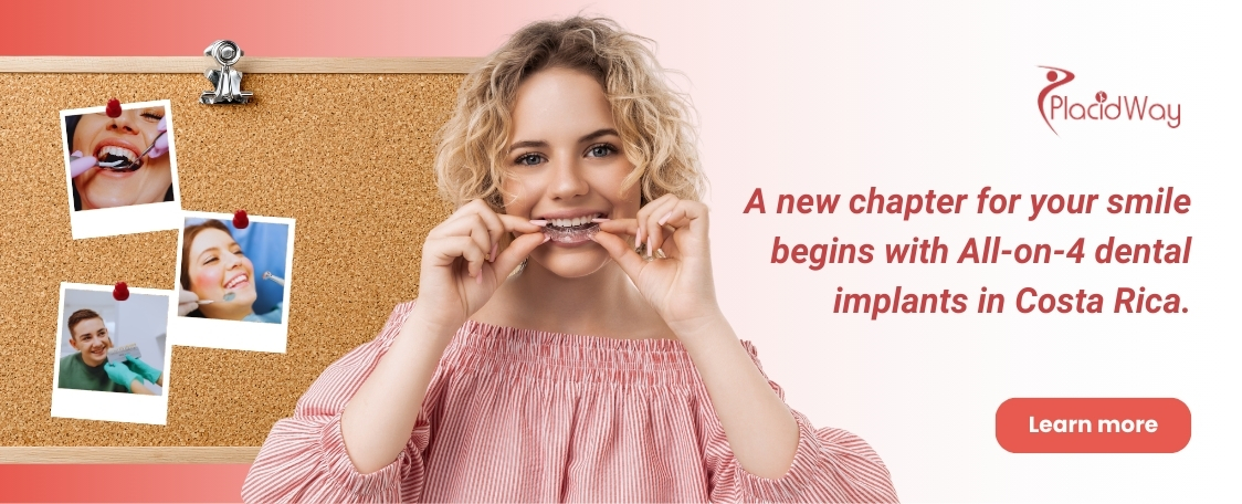 All on 4 Dental Implants in Costa Rica