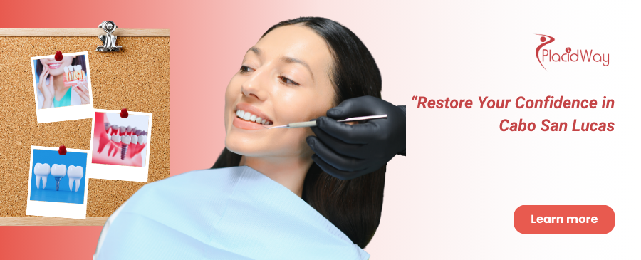 All on 4 Implants in Cabo San Lucas