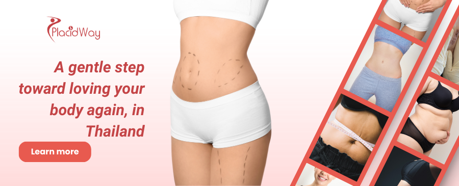 Tummy Tuck in Thailand