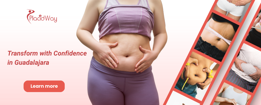 Tummy Tuck in Guadalajara Mexico – Get Pre-Baby Bodies Back!