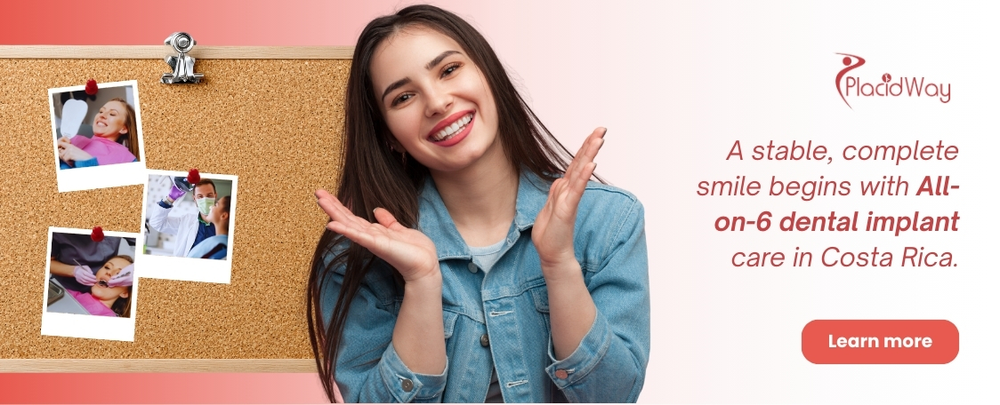 All on 6 Dental Implants in Costa Rica