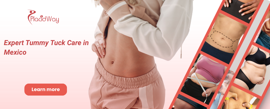 Tummy Tuck in Tijuana Mexico – Improve Your Body Shape!