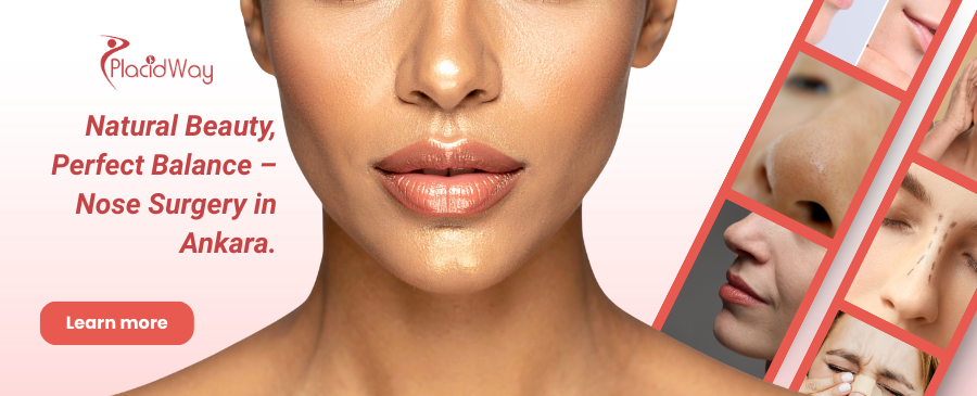 Rhinoplasty in Ankara, Turkey