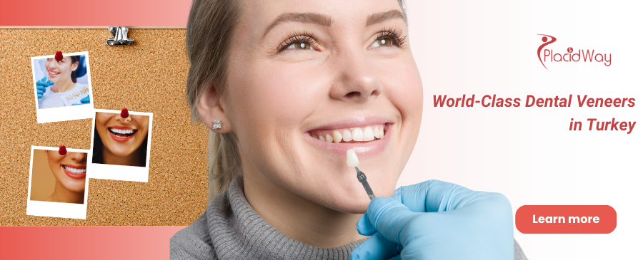Dental Veneers in Izmir, Turkey