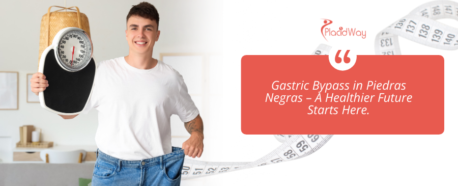 Gastric Bypass Surgery in Piedras Negras, Mexico