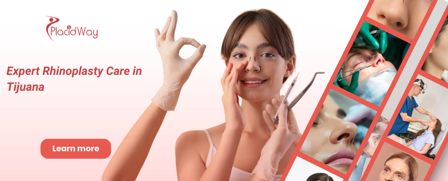 Rhinoplasty in Tijuana