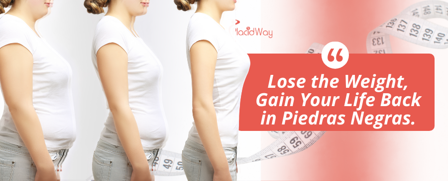 Gastric Sleeve Surgery in Piedras Negras, Mexico