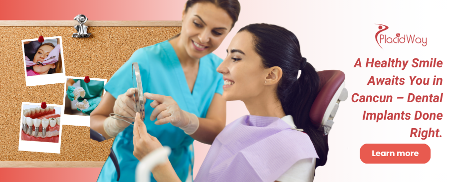 Dental Implants in Cancun, Mexico