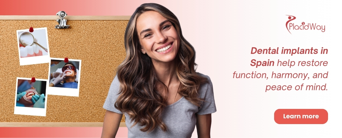 Impianti dentali in Spagna