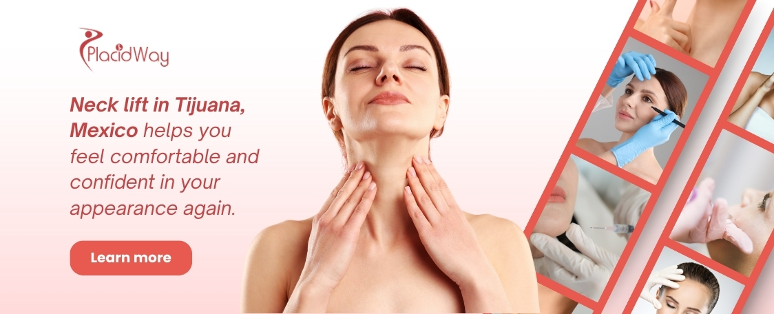 Neck Lift in Tijuana Mexico