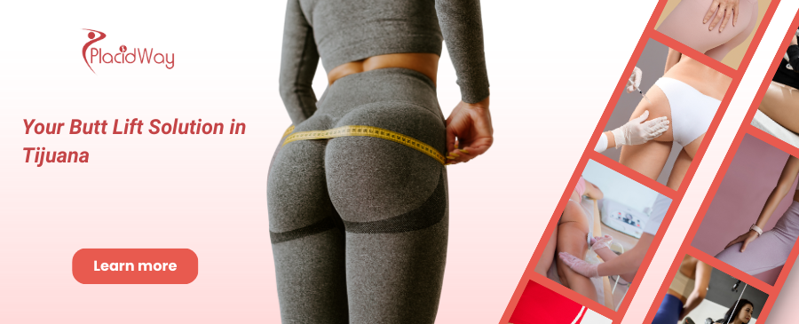 Brazilian Butt Lift in Tijuana, Mexico - Your Butt Lift Solution