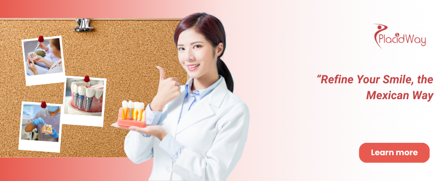 All on 8 Dental Implants in Tijuana - Affordable Dental Work in Mexico