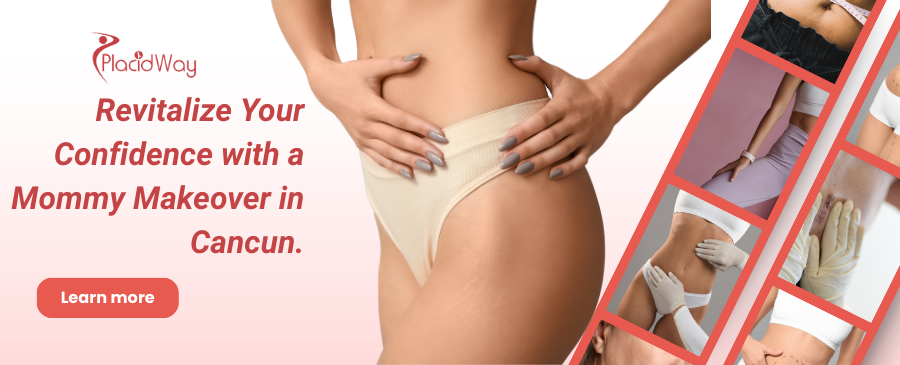 Mommy Makeover in Cancun, Mexico