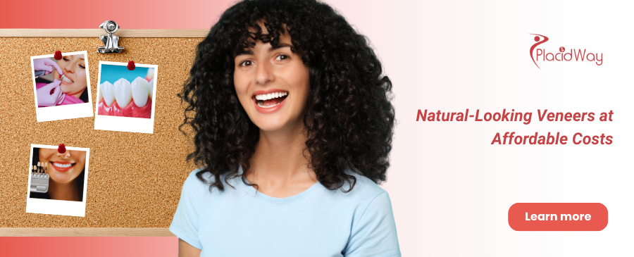 Dental Veneers in Tijuana, Mexico