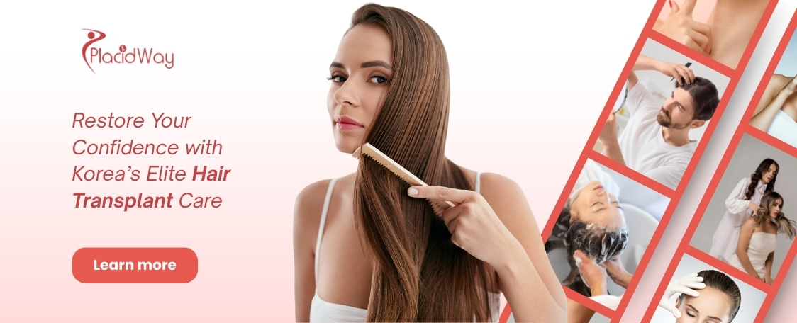 Hair Transplant in South Korea
