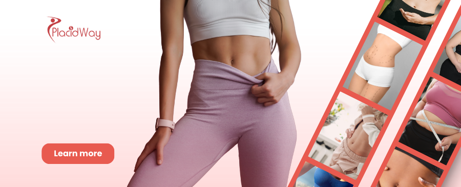 Tummy Tuck in Mexico City, Mexico