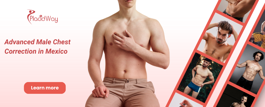Gynecomastia Guadalajara, Mexico