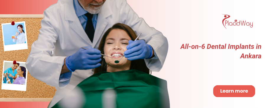 All-on-6 Implants Ankara, Turkey
