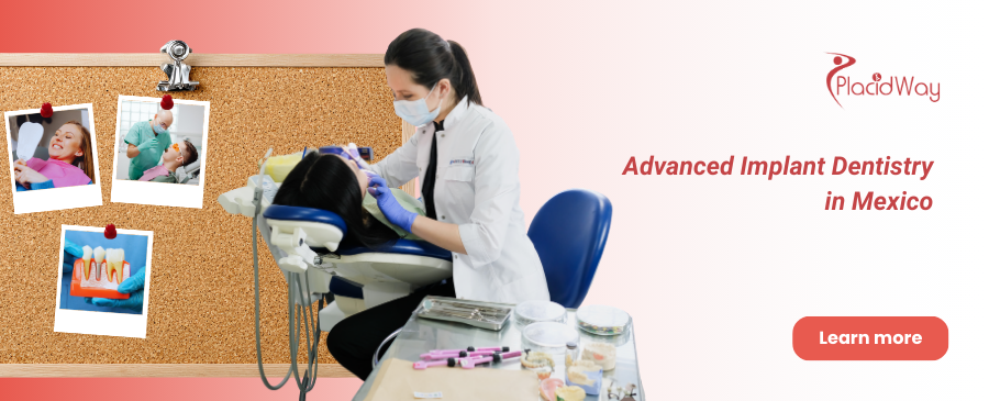 All on 6 Dental Implants in Cancun, Mexico