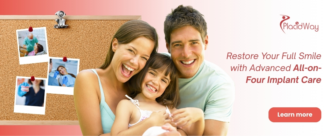 All-on-Four Dental Implants in Croatia