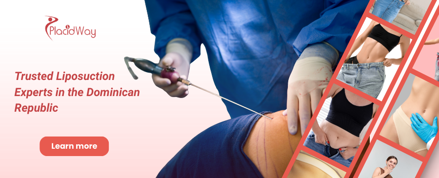 Liposuction in Santo Domingo, Dominican Republic
