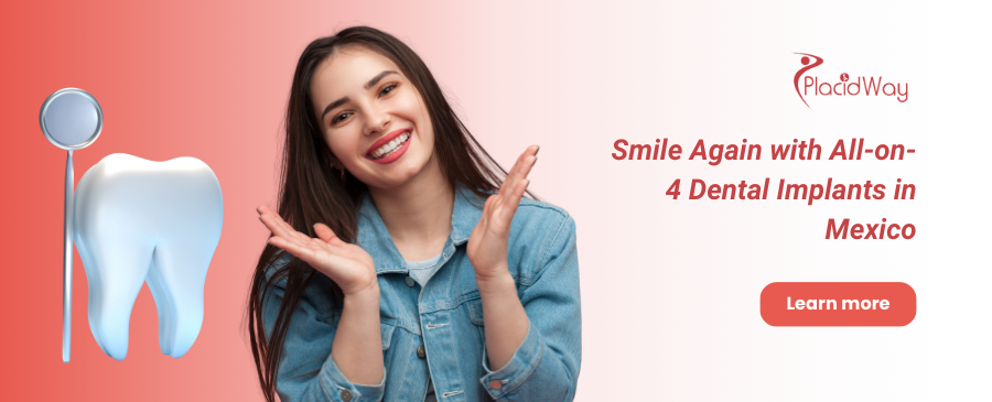 All on 4 Dental Implants in Mexico