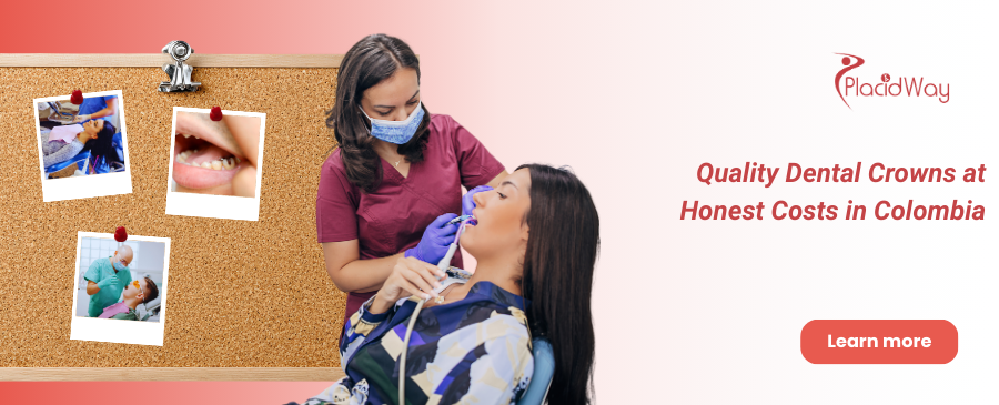 Dental Crowns in Bogota Colombia