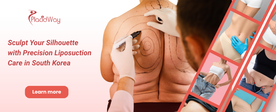Liposuction in South Korea