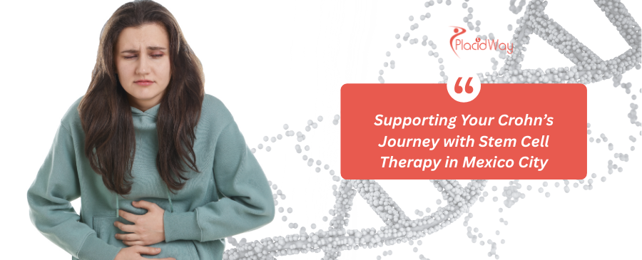 Stem Cell Treatment for Crohn Disease in Mexico City, Mexico