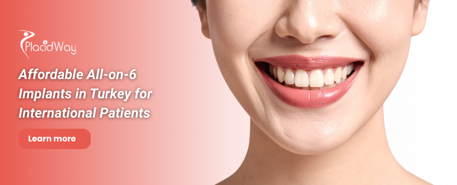 Implants dentaires All on 6 en Turquie