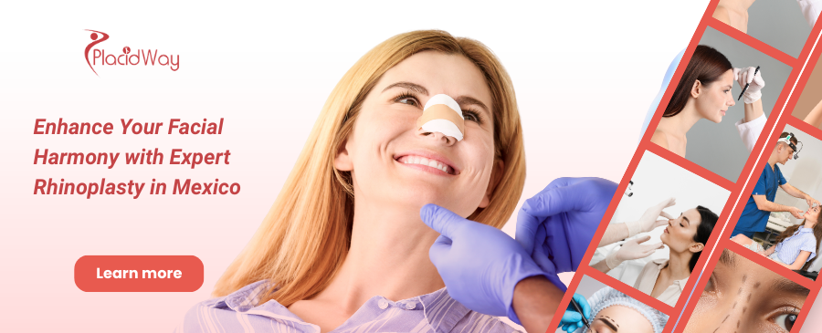 Rhinoplasty in Merida, Mexico