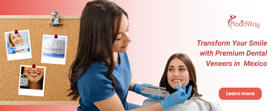 Dental Veneers in Juarez, Mexico