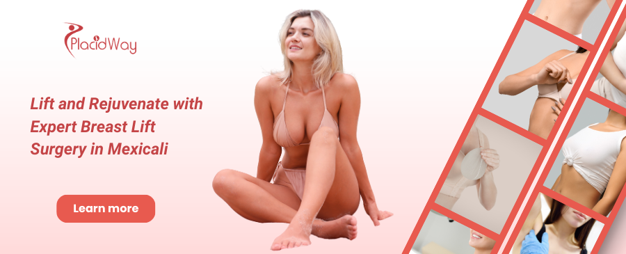 Breast Lift in Mexicali, Mexico