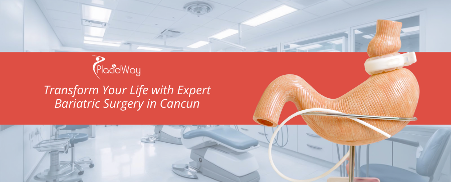 Bariatric Surgery in Cancun, Mexico - The Ultimate Guide