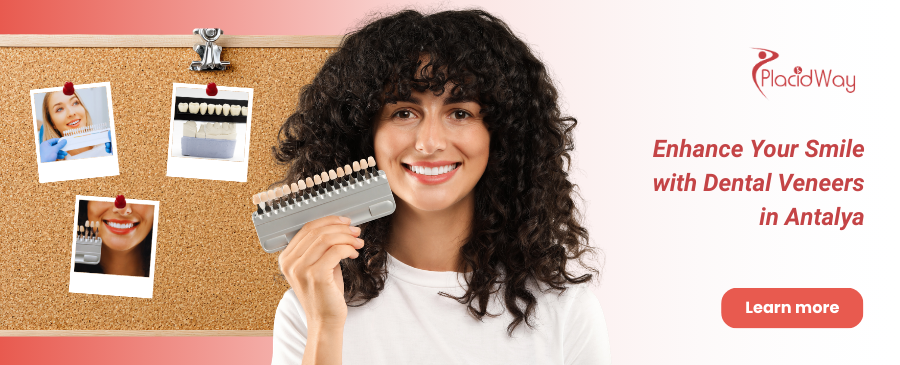 Dental Veneers in Antalya