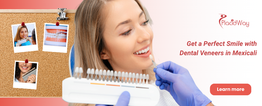 Dental Veneers in Mexicali