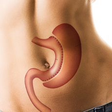 Gastelum Gastric Sleeve Package in Tijuana, Mexico