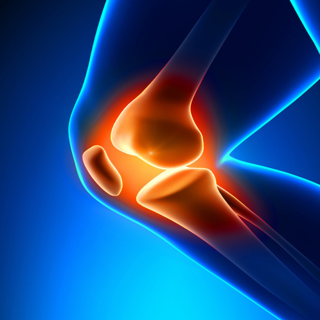 Stem Cell Therapy for Joints/Knees in Mexico City Mexico