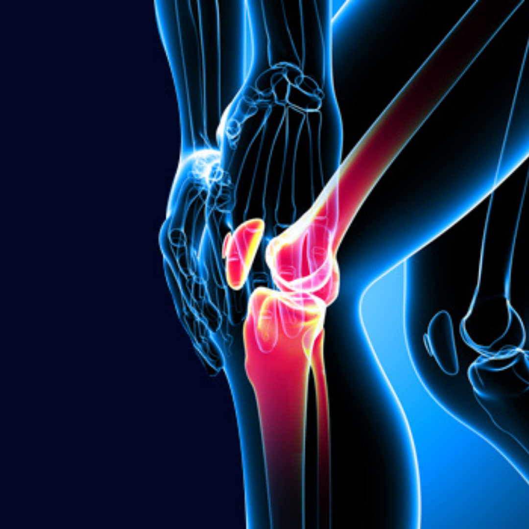 Advanced Knee Replacement Surgery in Europe and Asia