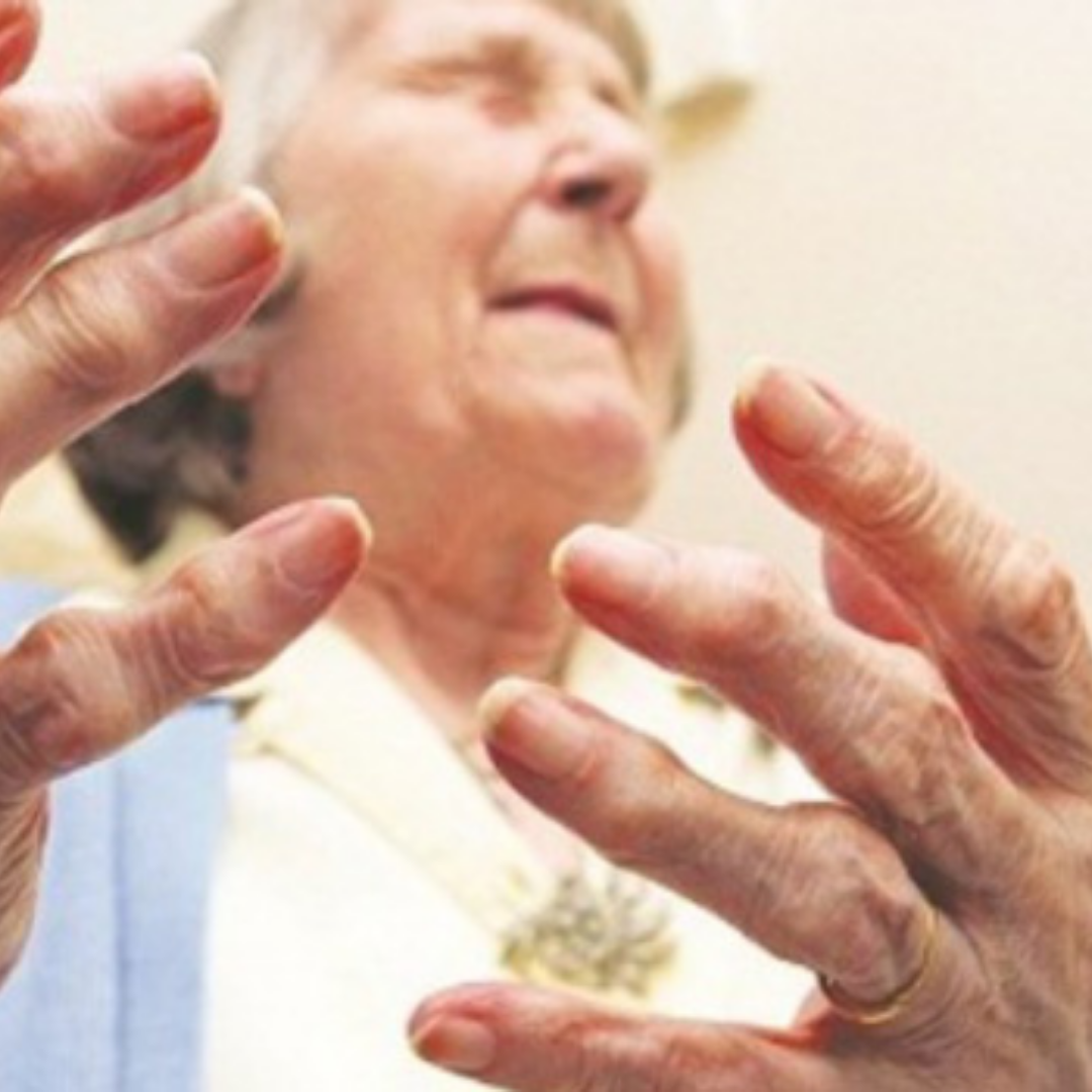 Chinese Medicine for Rheumatoid Arthritis in Beijing China