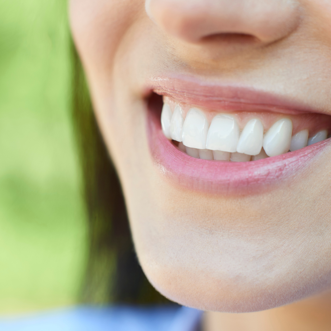 Effective Package for Dental Veneers in San Jose, Costa Rica