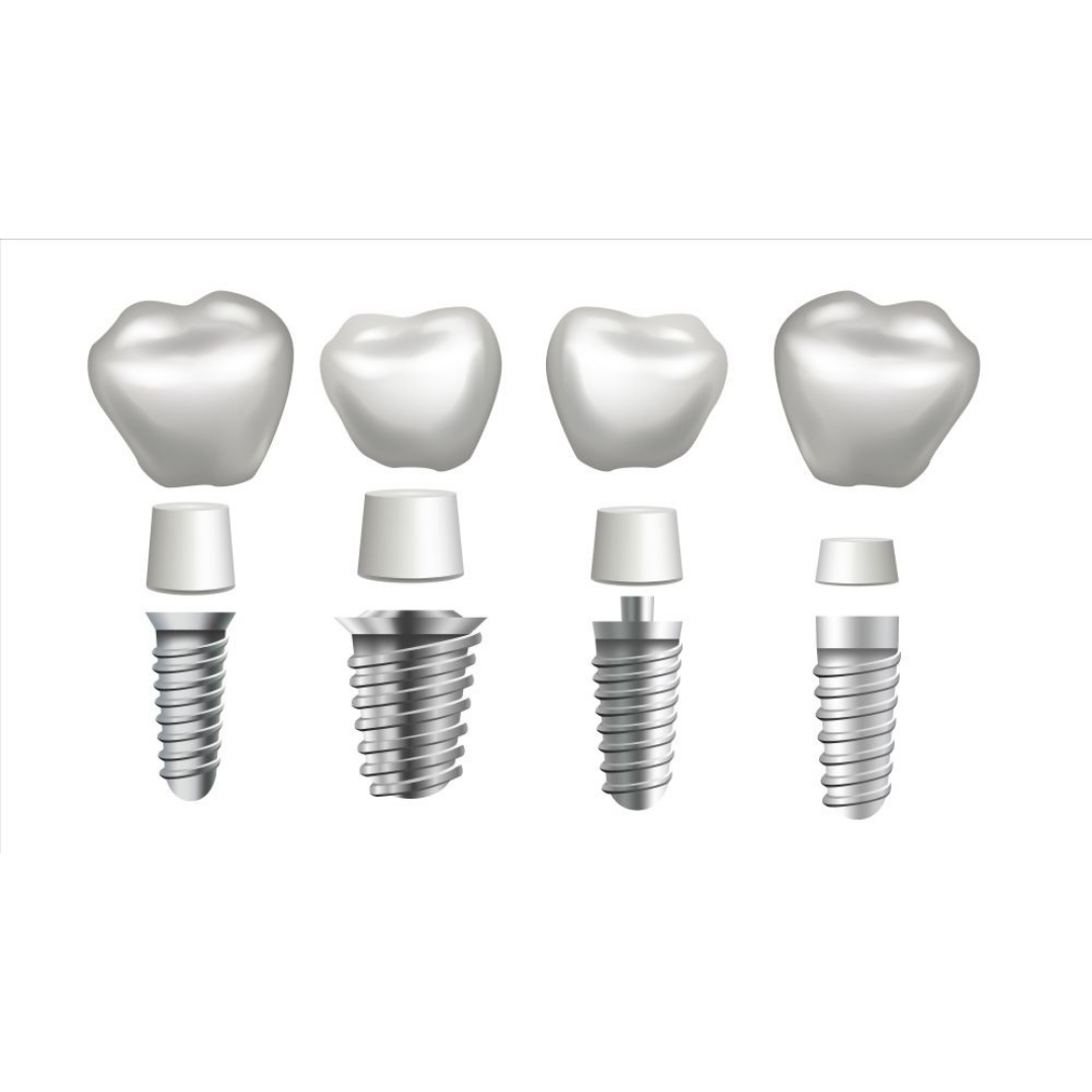 All on 4 Dental Implants in Puerto Vallarta, Mexico