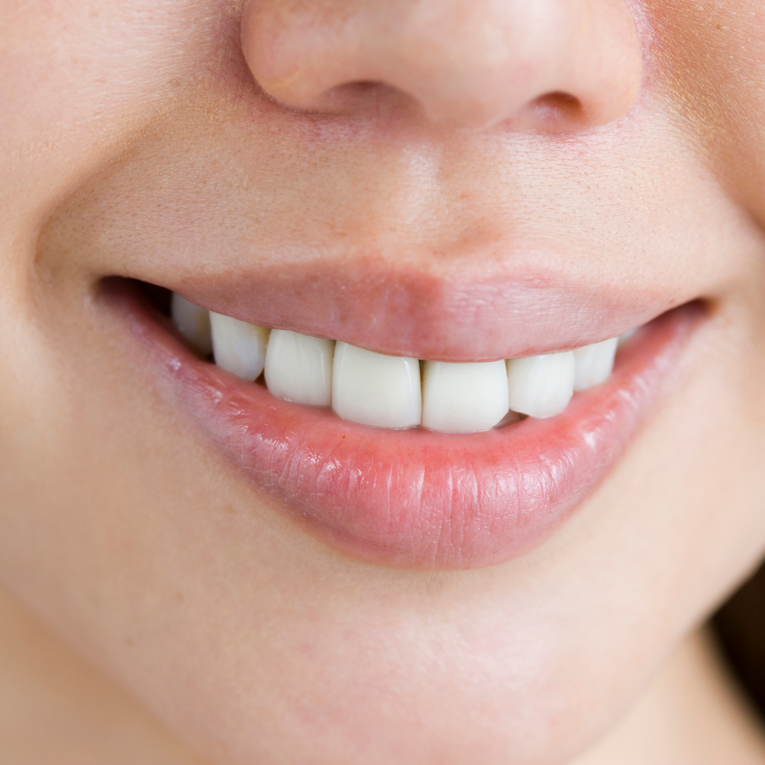 Affordable Teeth Whitening Package in Turkey
