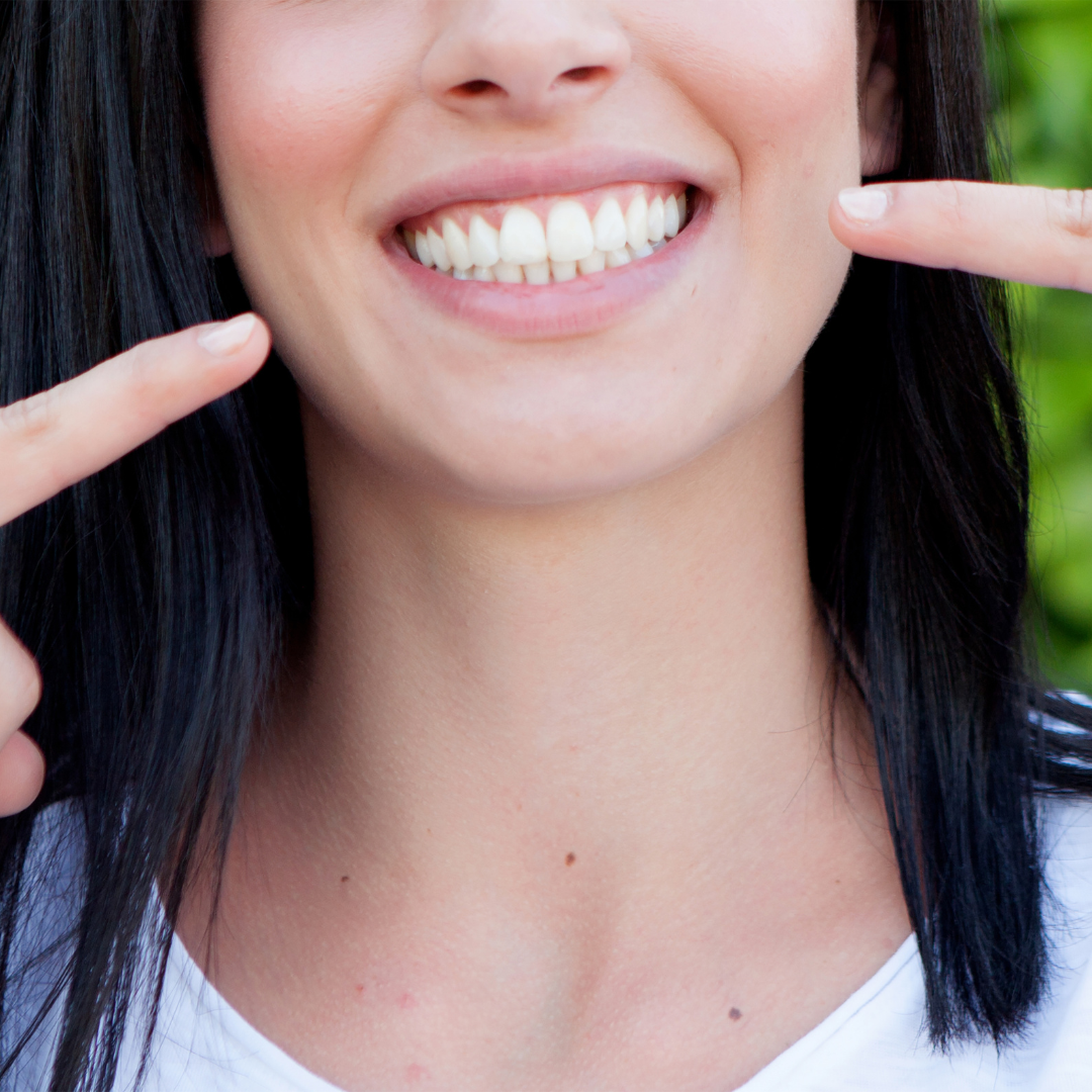 Best Package for Dental Veneers in Croatia