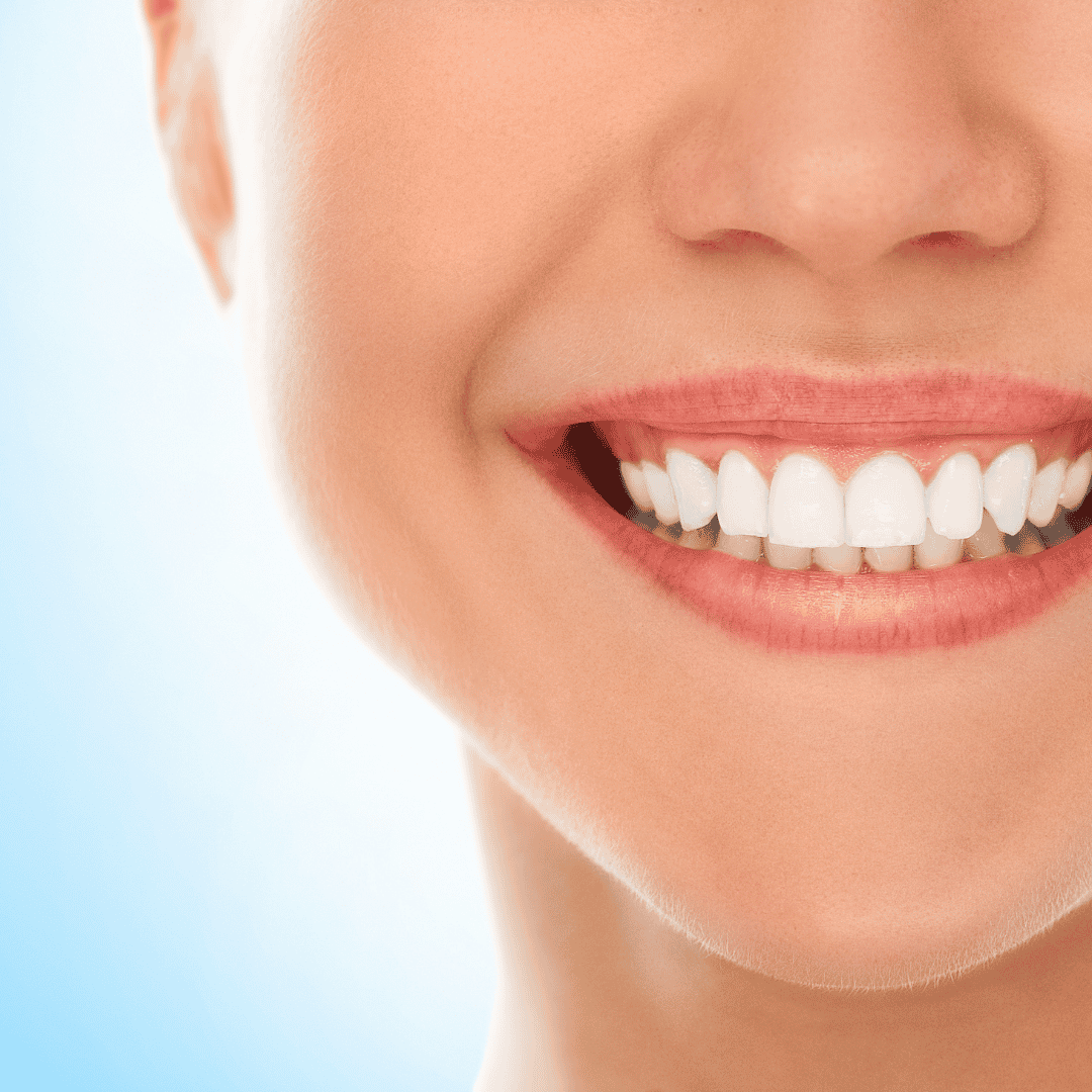 All on 6 Dental Implants NTA Packages in Izmir, Turkey