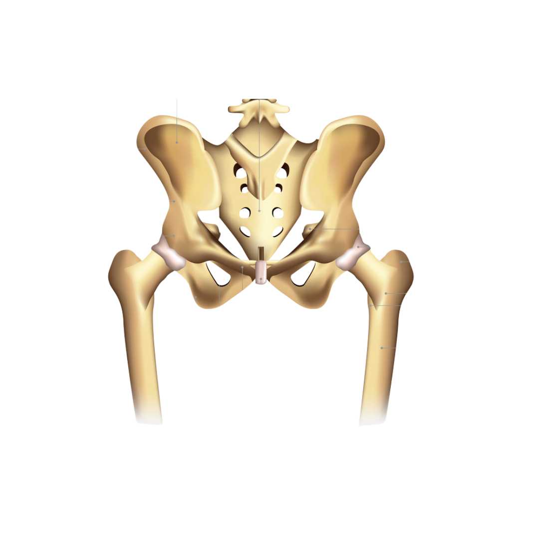 Hip Replacement Surgery in Mexico - Cost and Surgeons